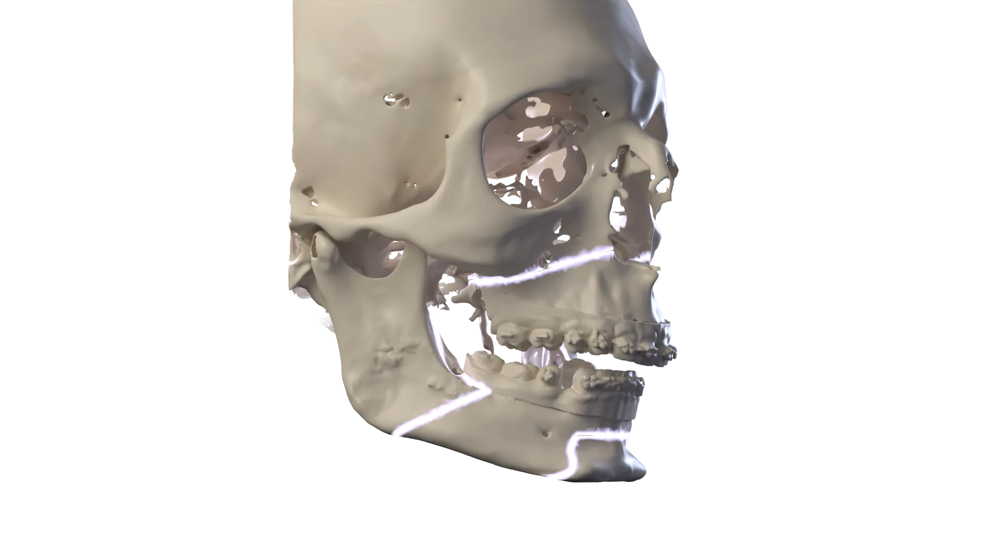 3D image: Chapter 2 · Your case